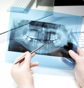 Studio Dentistico Semeghini Mauro_Radiologia dentale